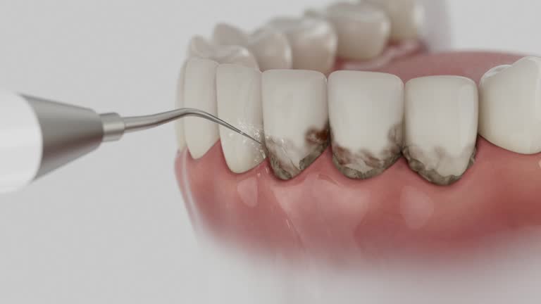 Reliable Emergency Dentist contractor in Loughman, FL by Smile Center Dentistry
